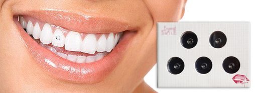 Скайсы (наклейки на зубы)