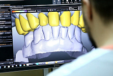 CAD/CAM системы в стоматологии