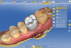 CAD/CAM системы в стоматологии